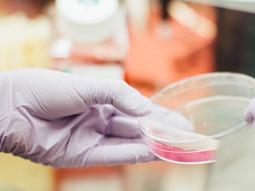 An exciting excursion into the field of bioprocess engineering