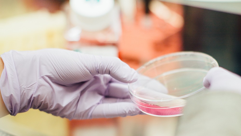 An exciting excursion into the field of bioprocess engineering